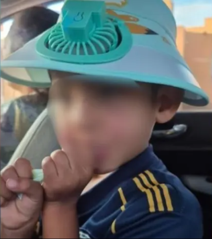 Avances en la salud del nene de 5 años derivado al Garrahan: se encuentra consciente y completó los injertos cutáneos